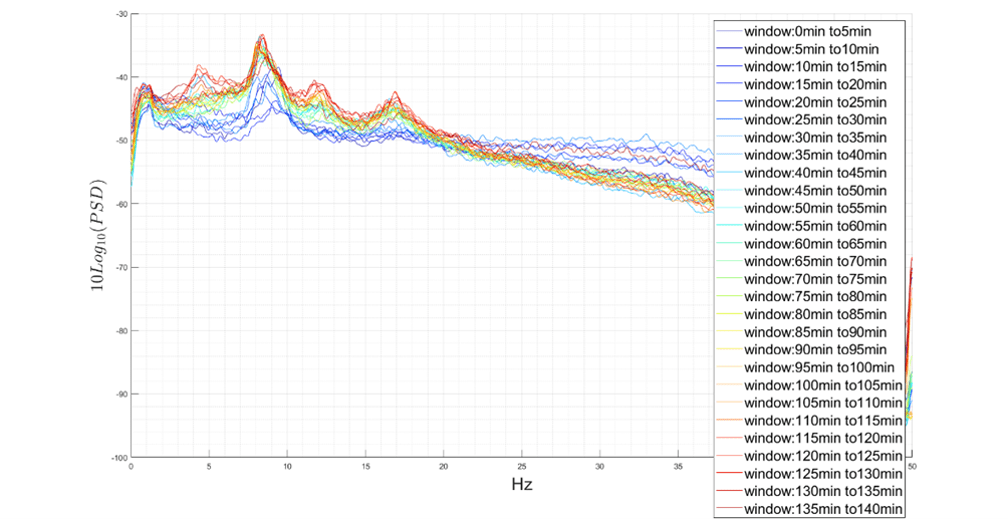 EEG recording result